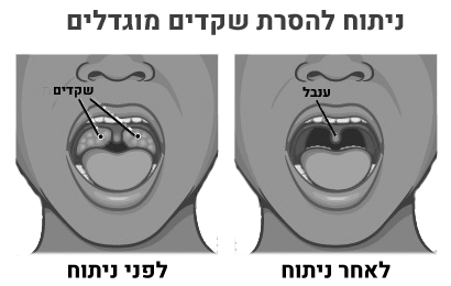 דום נשימה בילדים